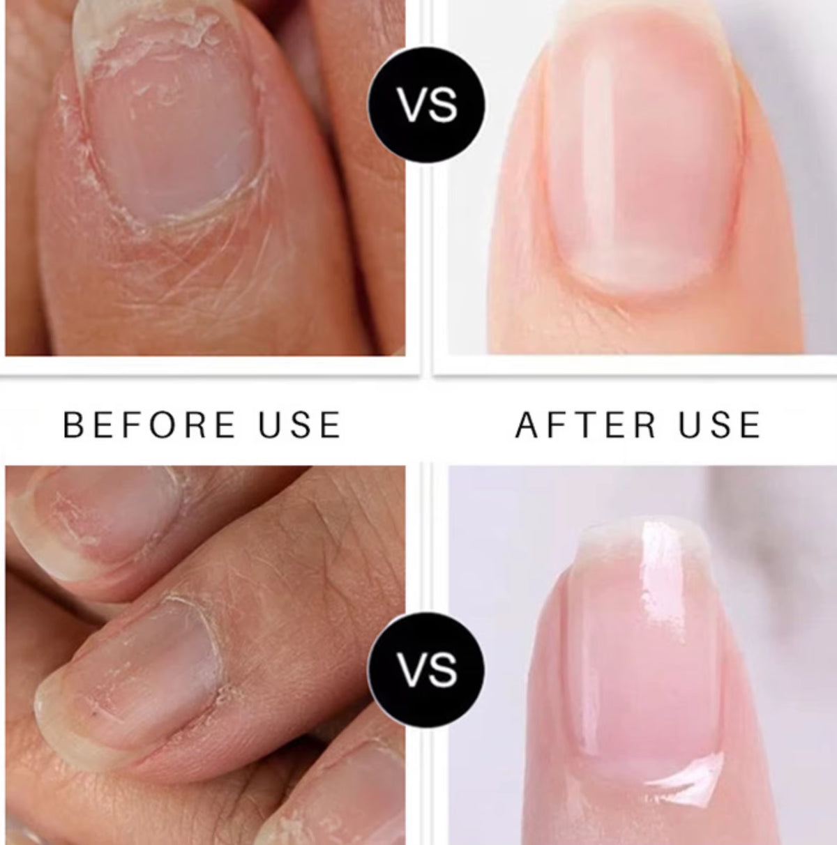 Wholesale Korean Nail Care Products Personal Nail Fungus Pen for Toenail & Fingernail Treatment Cuticle Oil Repair Pen