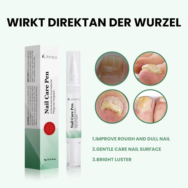 Wholesale Korean Nail Care Products Personal Nail Fungus Pen for Toenail & Fingernail Treatment Cuticle Oil Repair Pen